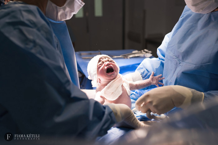 Primeiro choro bebê - fotografia de parto